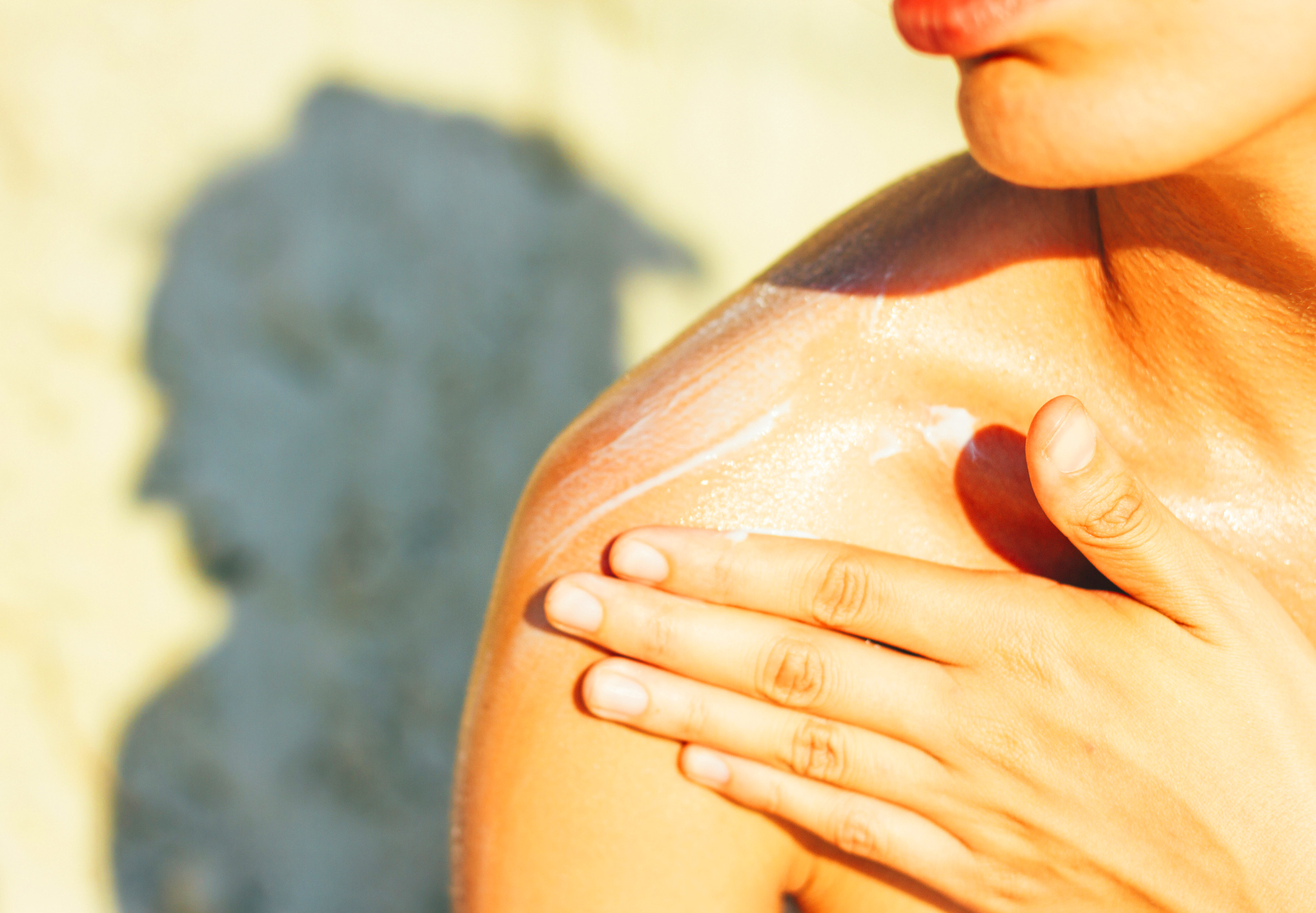 Transformer Coup De Soleil En Bronzage Biafine Les idées reçues sur les coups de soleil - Femme Actuelle